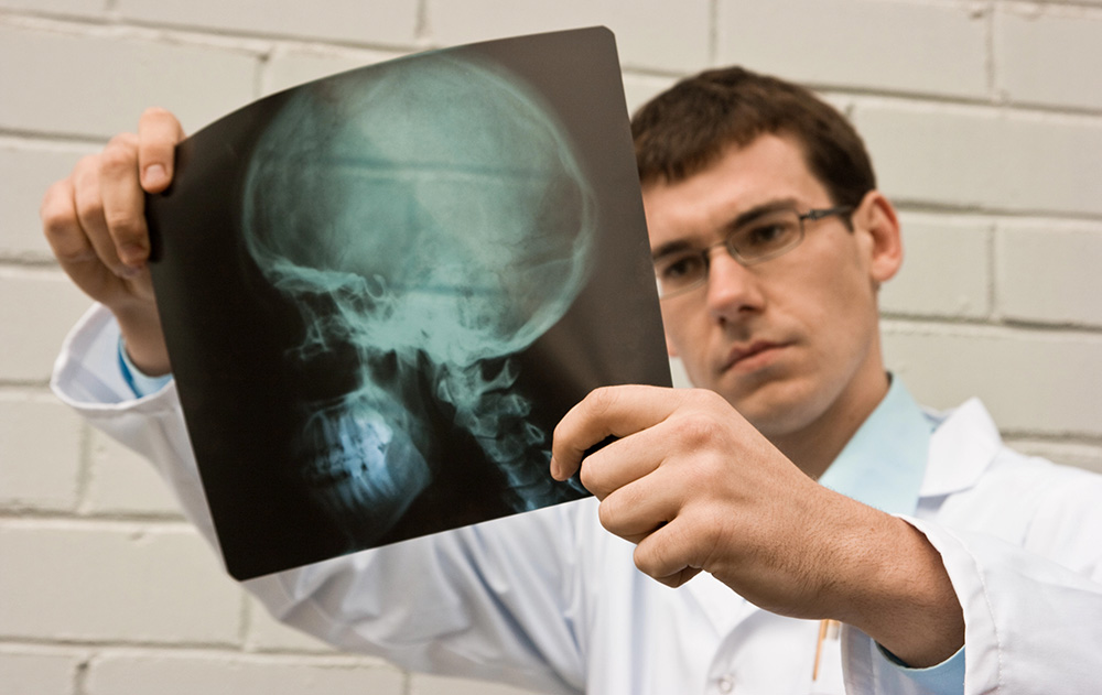 a doctor is reading a brain and spinal x ray